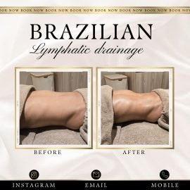 Brazilian Lymphatic Drainage (5 sessions)