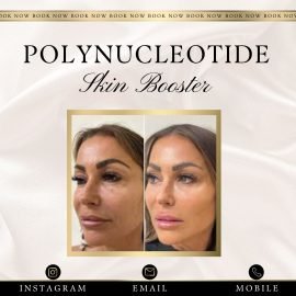Polynucleotide Skin Booster (2 sessions)